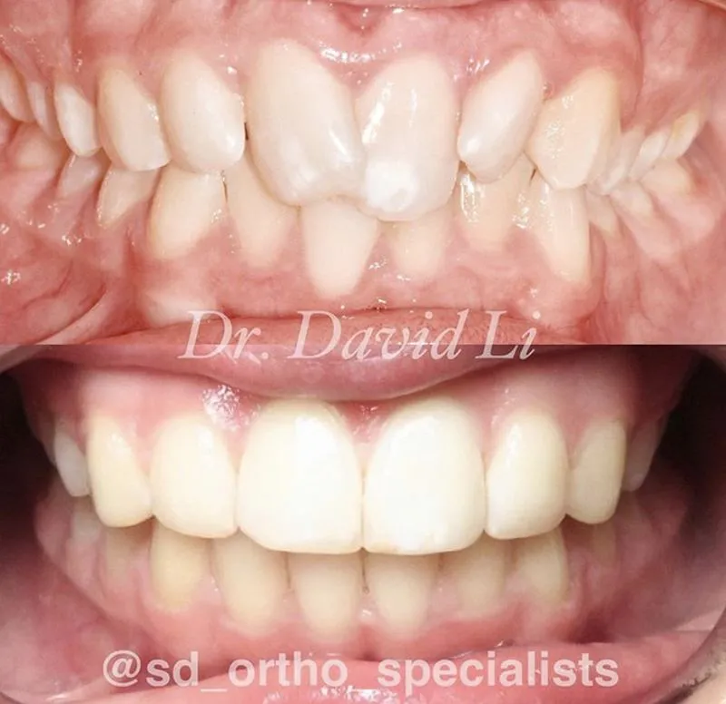 Confidence-boosting smile transformation