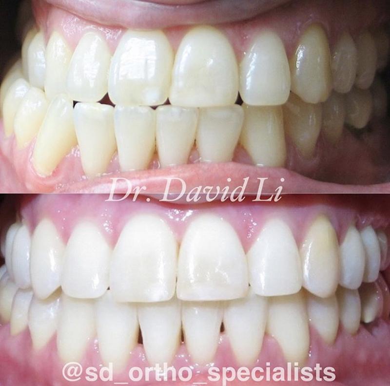 Before and Afters